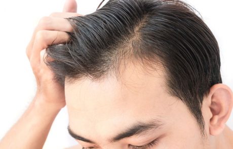 תקציר מחקר: השפעת טיפול בפלסמה עשירת טסיות לצמיחה מחודשת של השיער (PRP שיער)